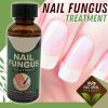 Anti Fungal Nail Treatment Nail Finger Toe Fungus Onychomycosis Remover