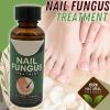 Anti Fungal Nail Treatment Nail Finger Toe Fungus Onychomycosis Remover